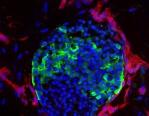 First Vascularized Organoid Model of Stem Cell-Derived Pancreatic Islets