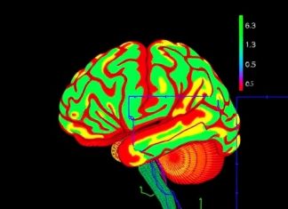 High-Density Brain-Wide Neural Recording in Primates