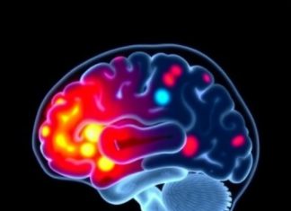 Vigabatrin-Linked Brain MRI Changes in Epileptic Kids