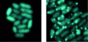 Antimicrobial Resistance Strategies May Be Informed by Bacteria’s Kiwa Phage Defense System
