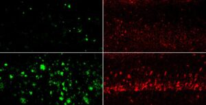 Alzheimer’s Pathology Reversed, Memory Restored with Lithium Compound in Mice