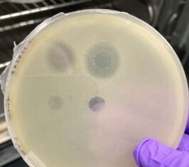 Antibacterials May One Day Be Derived from Ancient Archaea