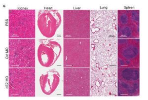 Antitumor Immunity May Be Enhanced by Tregs Expressing FOXP3 Variant