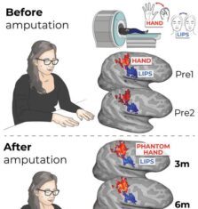 Brain’s Body Map Persists Even After Limb Amputation