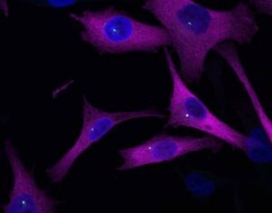 Melanoma Cells in Mice Steered by Protein’s Unexpected Function