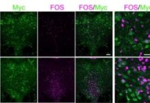 Mapping the Neural Mechanism Behind Social Isolation Following Immune Challenge