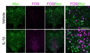 Mapping the Neural Mechanism Behind Social Isolation Following Immune Challenge