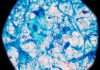 First human ‘lung-on-chip’ model developed using stem cells from a single donor