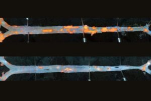 Immunotherapy Reduces Plaque in Mouse Arteries, Suggesting Coronary Disease Intervention