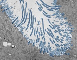 Nasal Passage Cell Response to Common Cold Virus Determines Sickness Severity