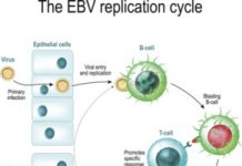 Twenty-Two Genes Could Hike Risk for Long-Term Health Issues After Epstein-Barr Infection