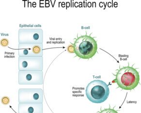Twenty-Two Genes Could Hike Risk for Long-Term Health Issues After Epstein-Barr Infection