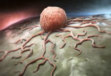 Vitamin A derivative suppresses immune response and cancer vaccine efficacy