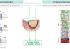 SolasCure completes Phase II clinical trial, demonstrating accelerated healing with Aurase Wound Gel