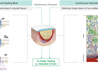SolasCure completes Phase II clinical trial, demonstrating accelerated healing with Aurase Wound Gel