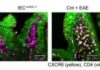 Gut-Immune Link Identified in Multiple Sclerosis-Related Neuroinflammation