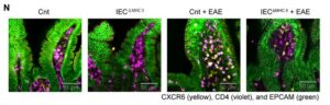 Gut-Immune Link Identified in Multiple Sclerosis-Related Neuroinflammation
