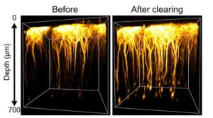 Seeing the Brain in a Different Light