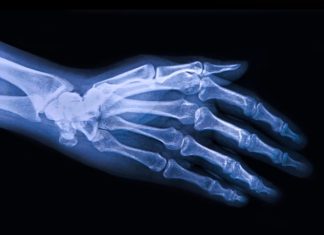 Study identifies protein that slows cartilage breakdown in joints