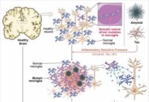 Alzheimer’s Linked to Cancer Mutations in Brain Immune Cells