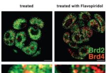 Cancer Drug Shortfalls Tied to How BET Inhibitors Hit BRD2 and BRD4 Differently