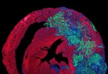 Heart’s Constant Beating Suppresses Tumor Growth in Cardiac Tissues