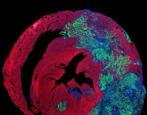 Heart’s Constant Beating Suppresses Tumor Growth in Cardiac Tissues
