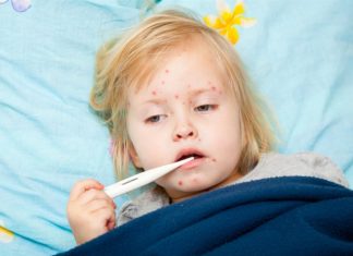 US scientists sequence 1,000 genomes from measles, a disease long eliminated with vaccines