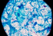 Portable MiniDock MTB delivers tuberculosis results in thirty minutes
