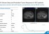 ASCO 2026 | Oricell’s GPC3 CAR-T Ori-C101 Hits 66.7% ORR in Late-Line HCC, Signaling Best-in-Class Potential