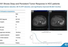 ASCO 2026 | Oricell’s GPC3 CAR-T Ori-C101 Hits 66.7% ORR in Late-Line HCC, Signaling Best-in-Class Potential