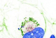 Collagen Resides Inside Cells in Liquid Condensate-Like Form