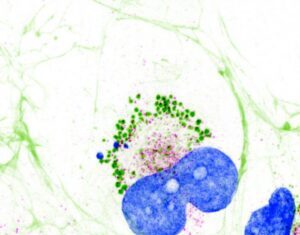 Collagen Resides Inside Cells in Liquid Condensate-Like Form