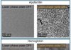 Laser‑Driven Phase Contrast Enhances Cryo‑EM Resolution of Small Proteins