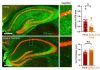Protein Protects Against Tau Tangles, Synaptic Loss in Mouse Model of Tauopathy
