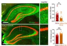 Protein Protects Against Tau Tangles, Synaptic Loss in Mouse Model of Tauopathy