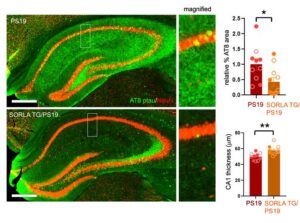 Protein Protects Against Tau Tangles, Synaptic Loss in Mouse Model of Tauopathy