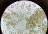 Algae-Based Food Product Development Earns Gates Foundation Award
