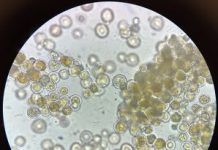 Algae-Based Food Product Development Earns Gates Foundation Award