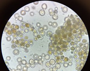 Algae-Based Food Product Development Earns Gates Foundation Award