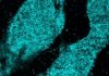 Skull Immune Structures May Provide First Response Against Brain Cancer