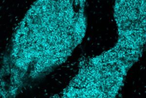 Skull Immune Structures May Provide First Response Against Brain Cancer