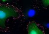 Cryo-EM and AI-Designed Scaffold Reveal How Andes Hantavirus Binds Cells