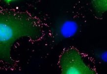 Cryo-EM and AI-Designed Scaffold Reveal How Andes Hantavirus Binds Cells