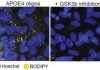How Alzheimer’s Risk Gene APOE4 Disrupts Myelination