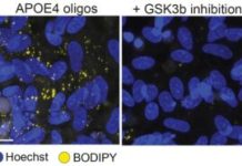 How Alzheimer’s Risk Gene APOE4 Disrupts Myelination