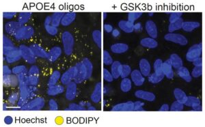 How Alzheimer’s Risk Gene APOE4 Disrupts Myelination